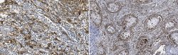 Podoplanin, Mouse anti-Human, Clone: LpMab-19, Millipore Sigma 25&mu;g;
